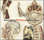 Emergency Medicine Ireland